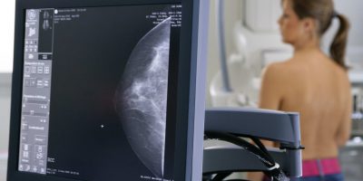 mamografie, mamograma, mamografist, medic imagistica, cancer de san, leziune san, nodul, ganglion, adenopatie, mastoza, interpretare mamografie, neoplasm san, stereotaxie, punctie san, biopsie san, screening, screening mamografic,