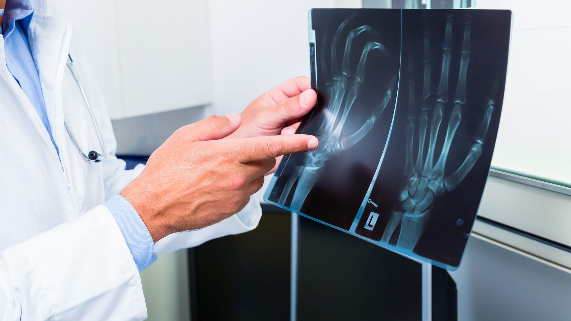 radiografie ortopedie pret)