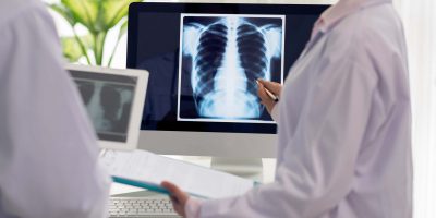 radiografii la domiciliu inflamație la nivelul uretrei din cauza prostatitei