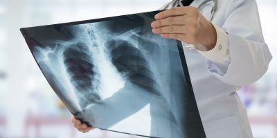 Afectiuni frecvente descoperite cu ajutorul radiologiei si al imagisticii medicale - Alpha Clinic